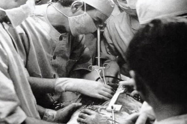 first heart transplant