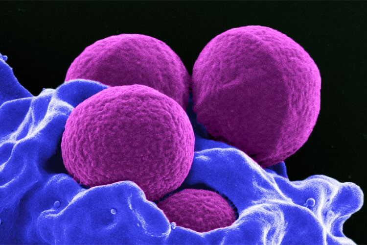 bactéries rondes