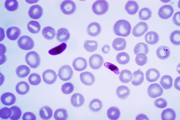 Plasmodium